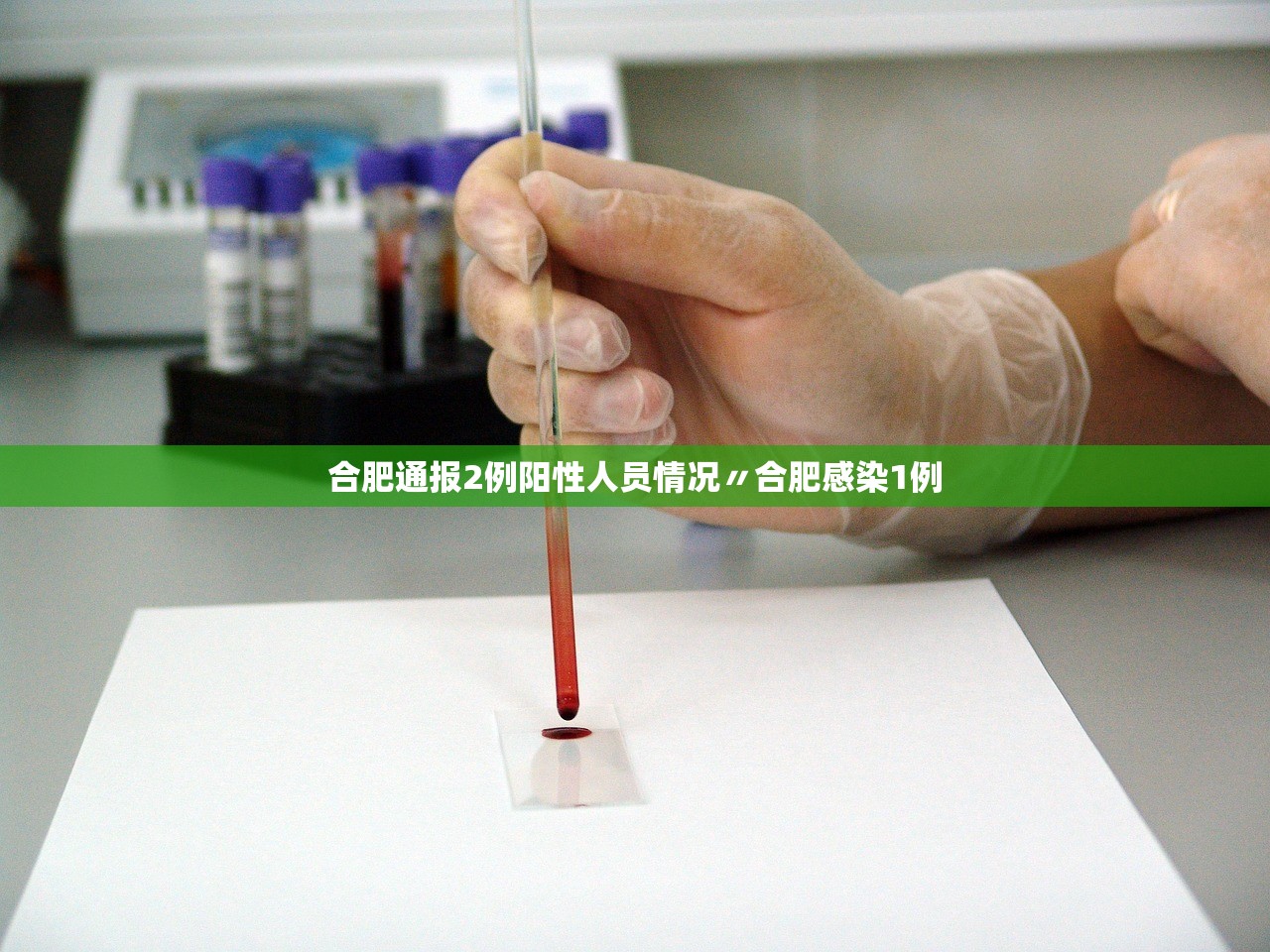 合肥通报2例阳性人员情况〃合肥感染1例