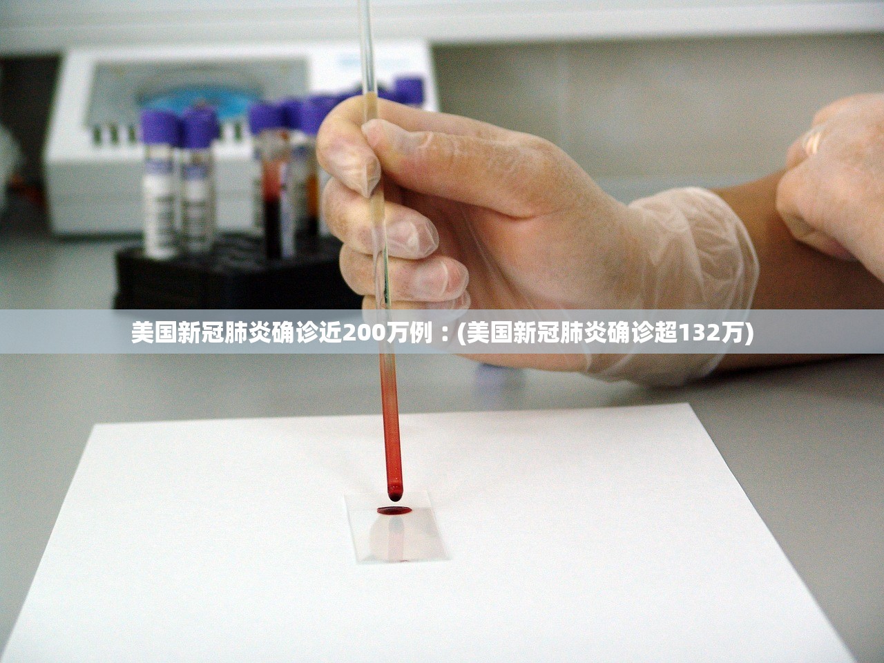 美国新冠肺炎确诊近200万例︰(美国新冠肺炎确诊超132万)